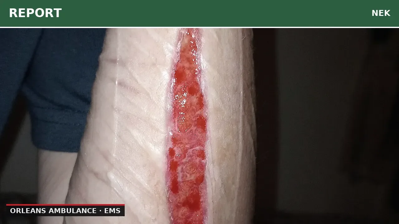 45-Year-Old Man with Severe Bleeding in Orleans