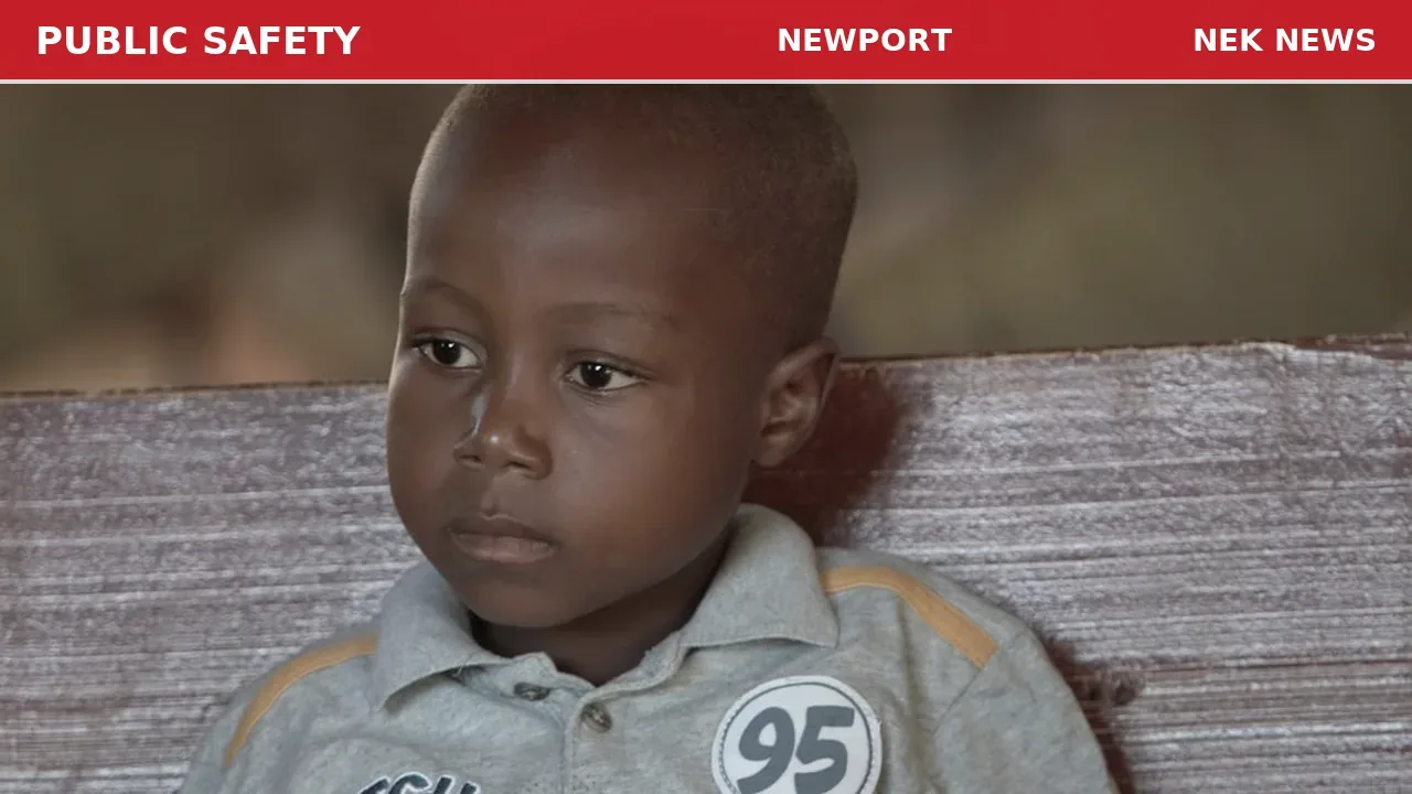Child hits head in Derby